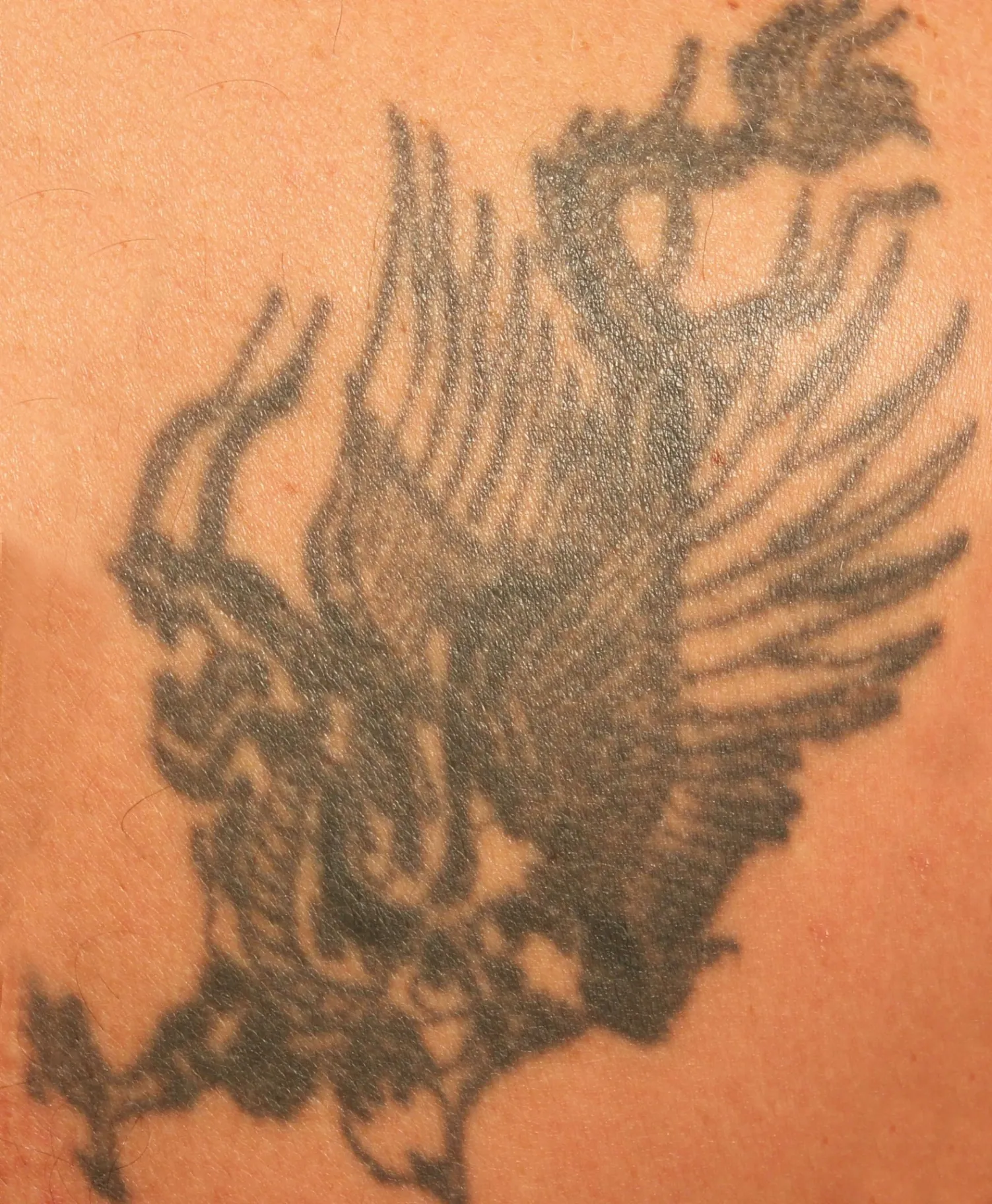 Wing Design — tattoo before laser removal treatment
