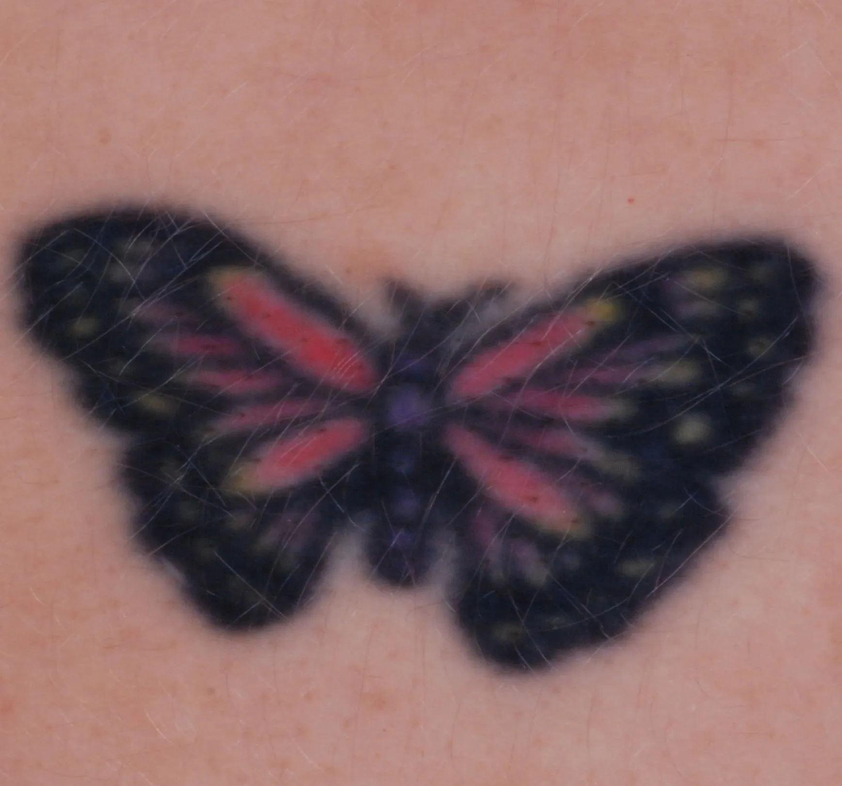 Colourful Butterfly — tattoo before laser removal treatment