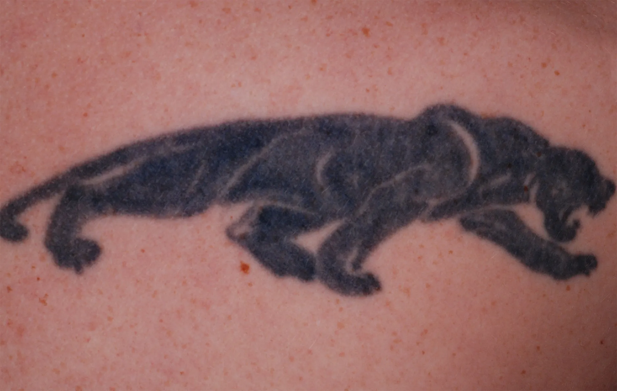 Panther Silhouette — tattoo before laser removal treatment