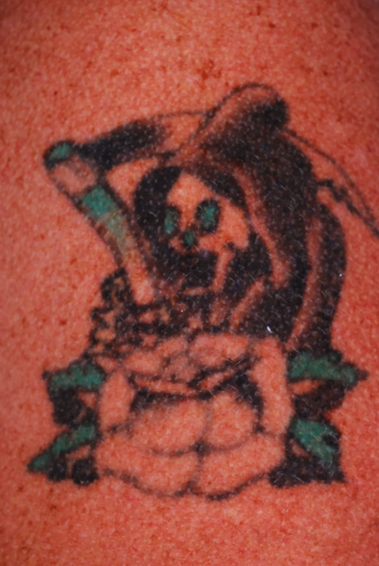 Skeleton Figure — tattoo before laser removal treatment