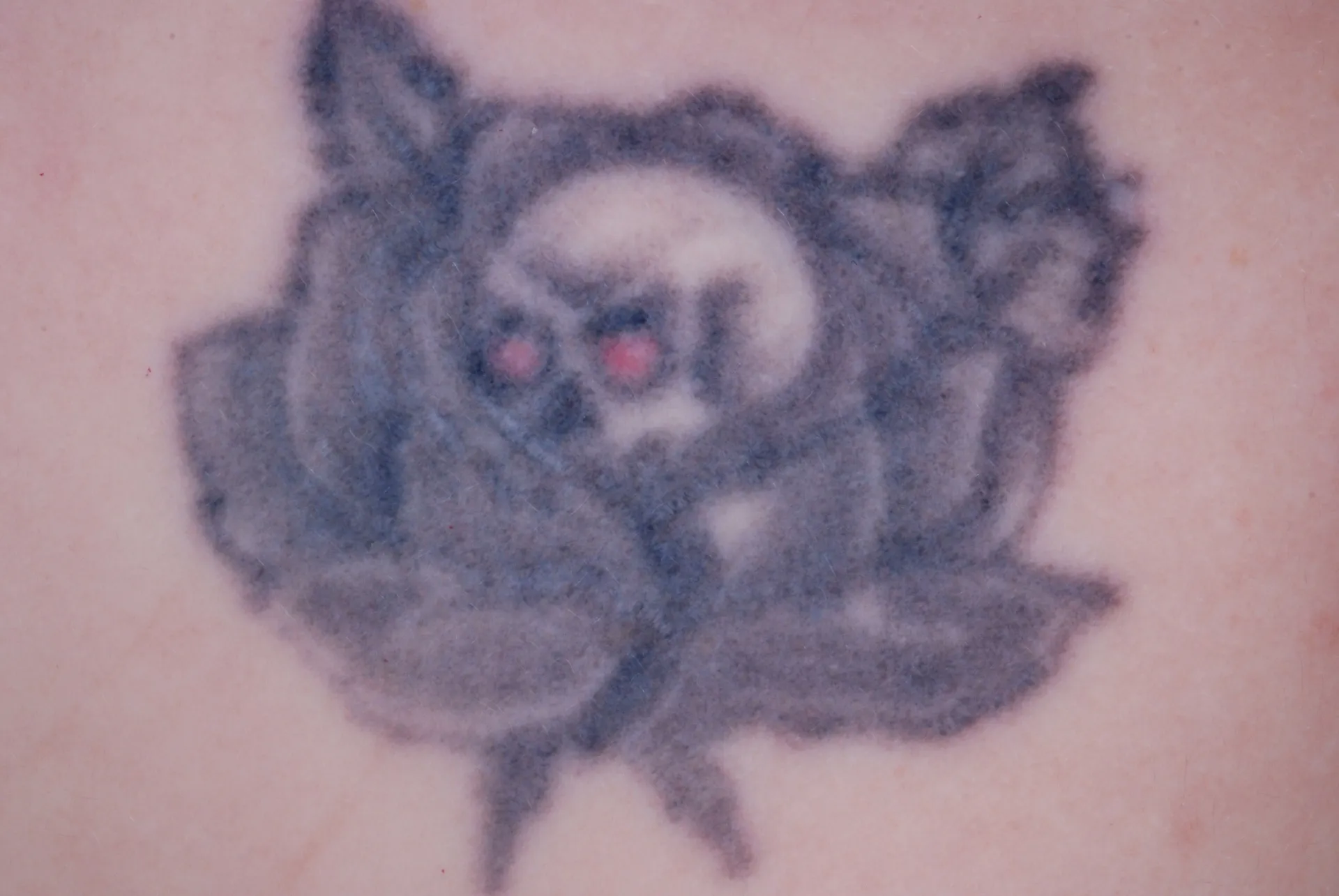 Skull with Wings — tattoo before laser removal treatment