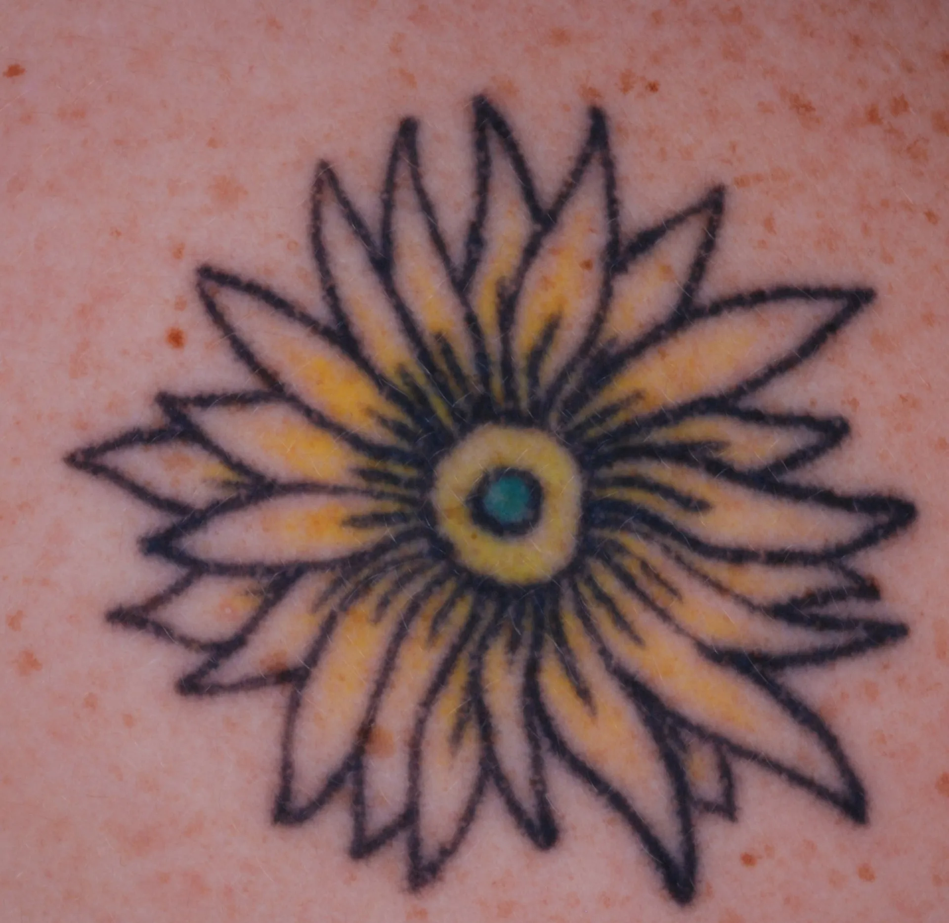 Sunflower — tattoo before laser removal treatment
