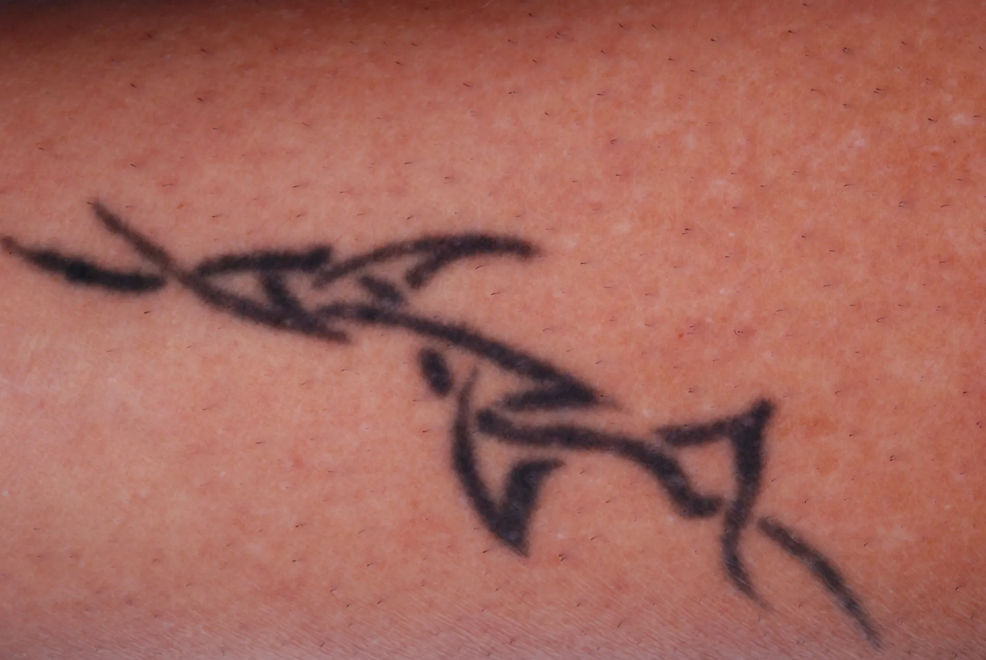 Black Tribal — tattoo before laser removal treatment
