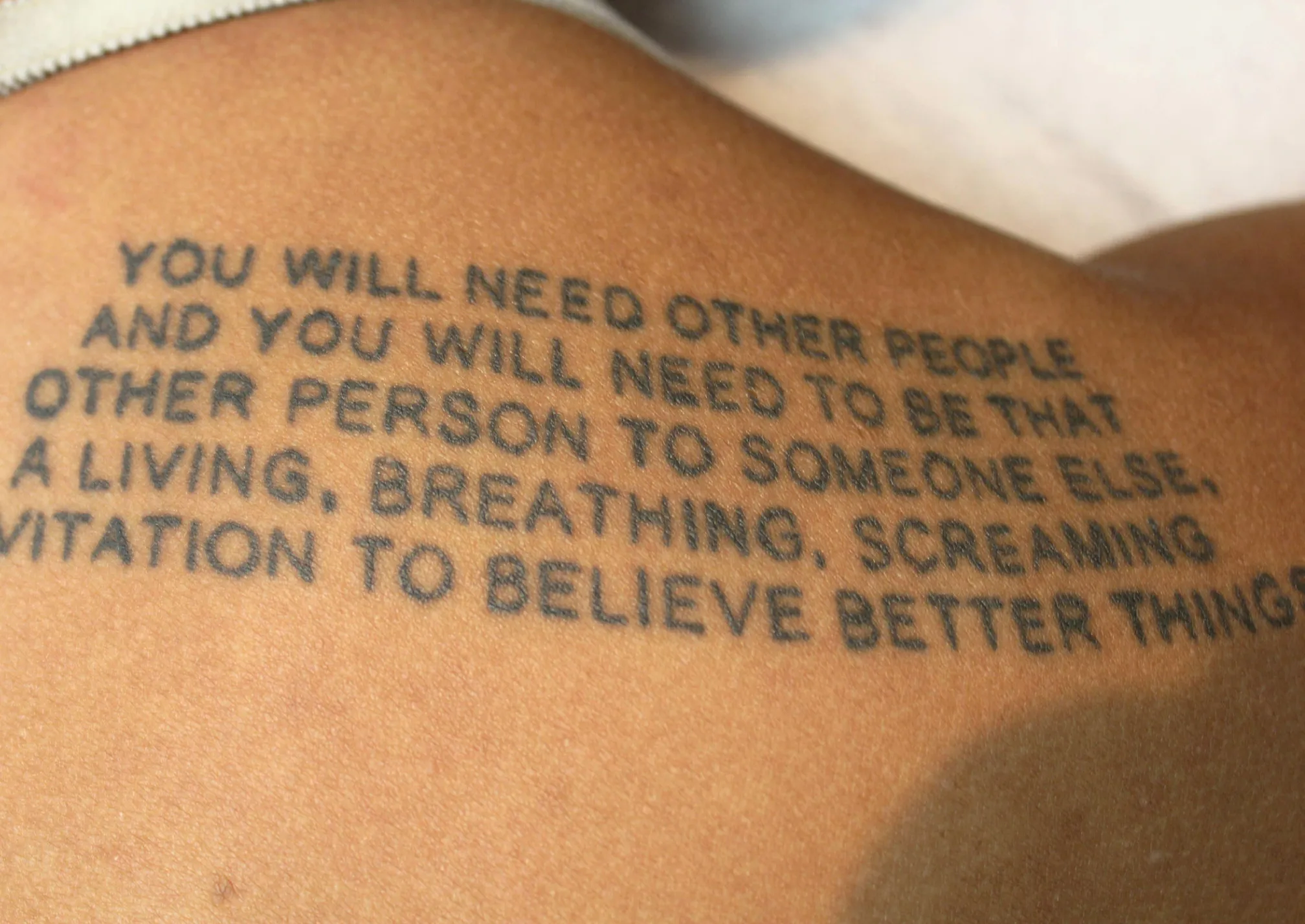 Text Quote — before laser tattoo removal
