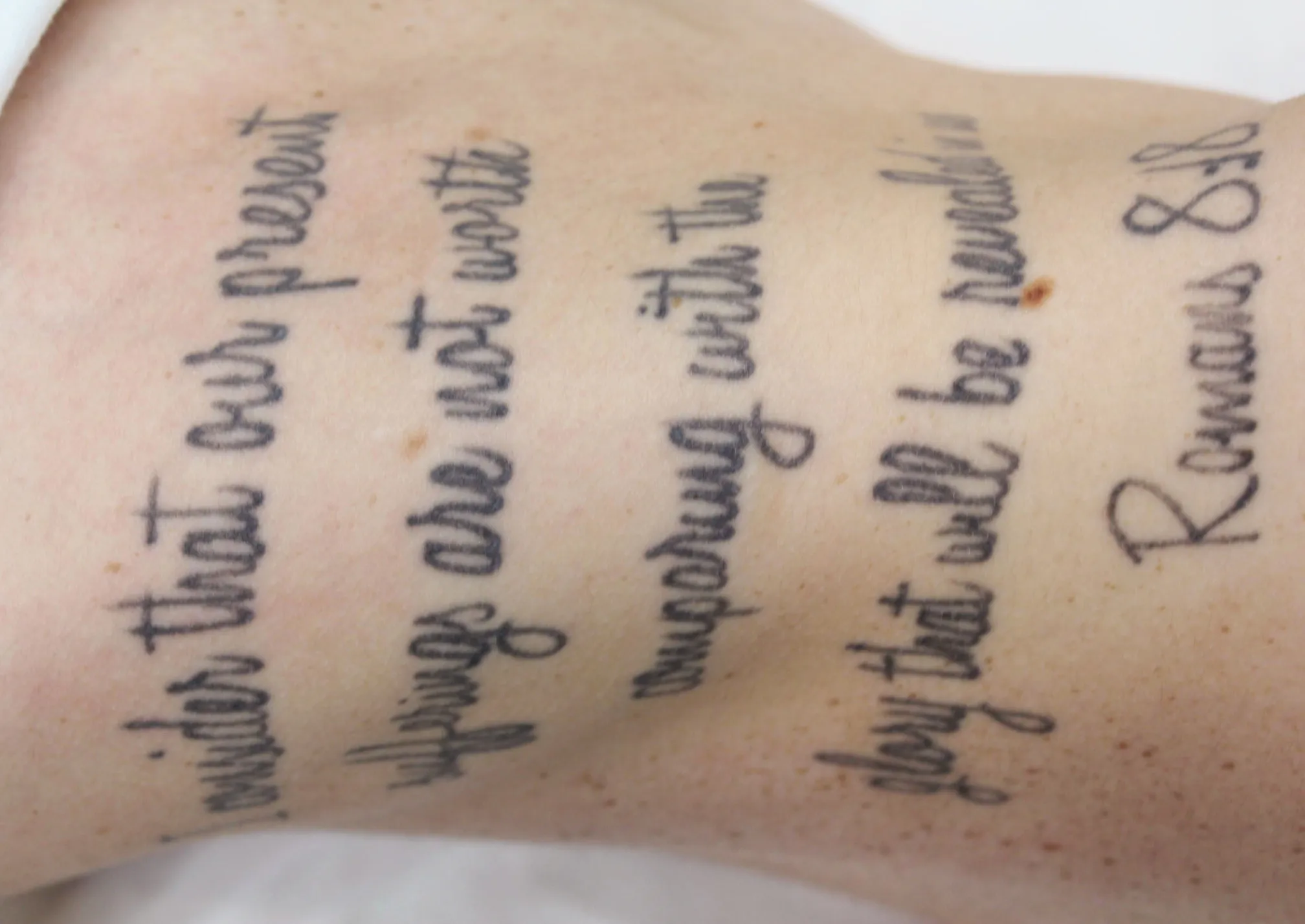 Cursive Script — before laser tattoo removal