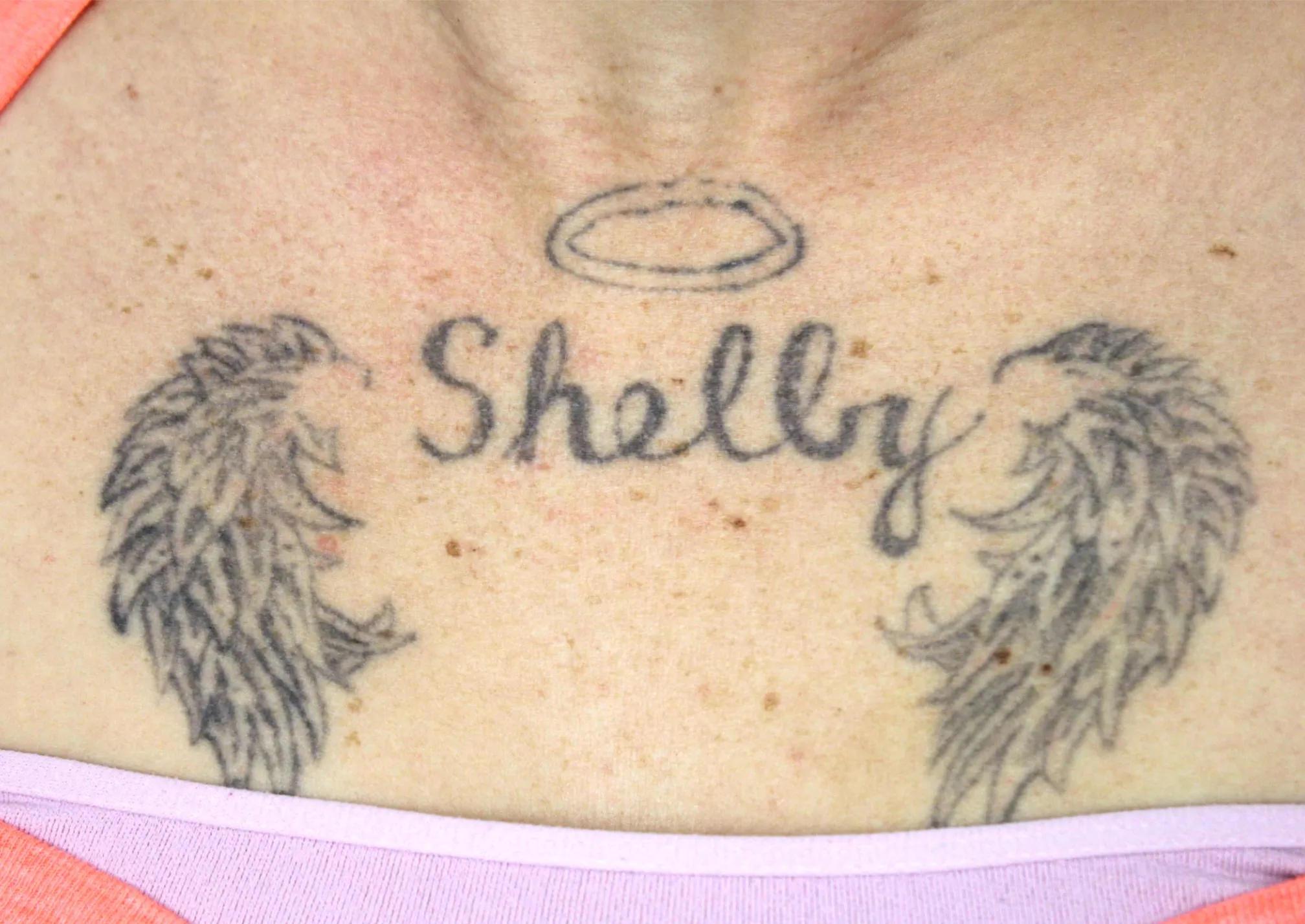 Memorial Wings — before laser tattoo removal